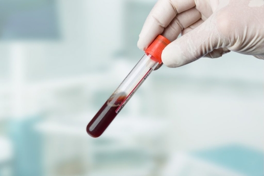 Emoglobina nel sangue: i valori da tenere sotto controllo