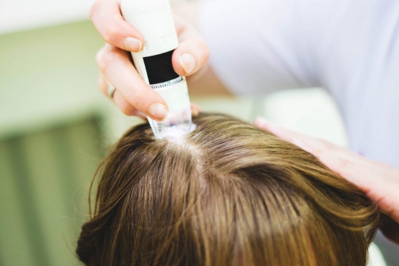 Esame del capello: come si svolge il test sul cuoio capelluto